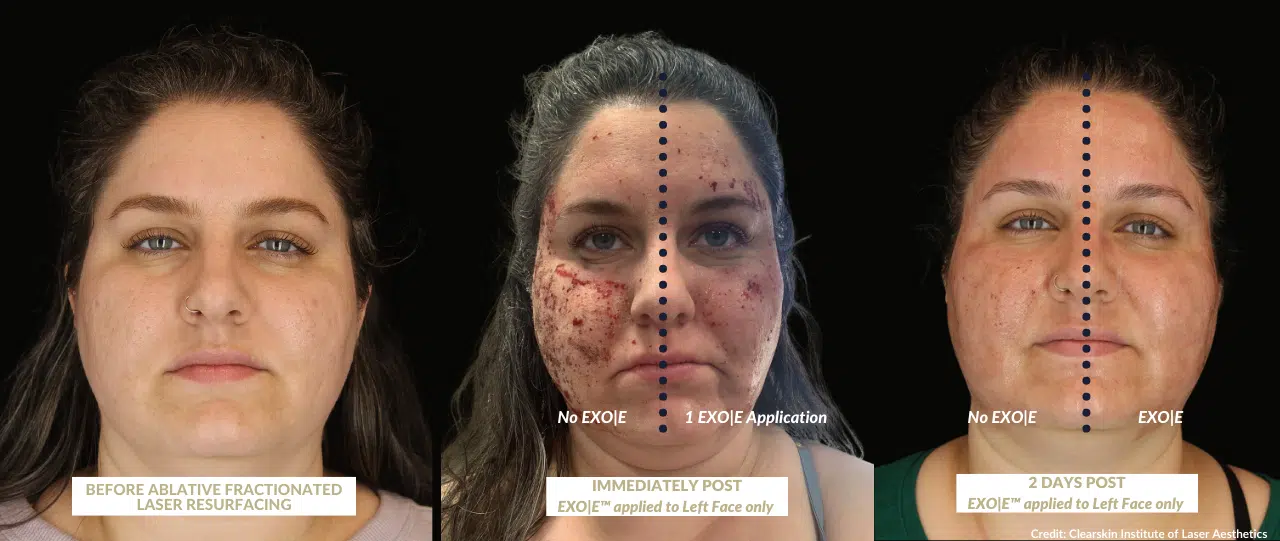 EXO|E Skin Revitalizing Complex infographic