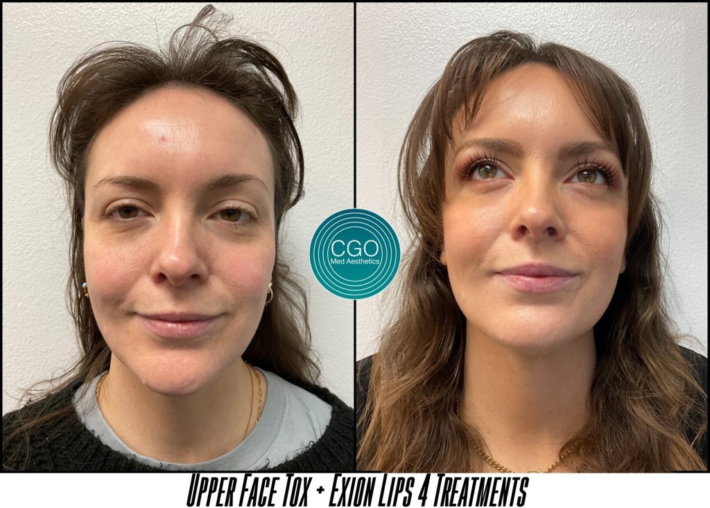 69a1bd4a5e39a3f0016f1ec2 14541512510 - Aesthetic Clinic San Diego