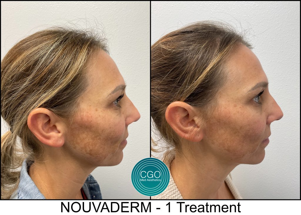 69a1bd4a5e39a3f0016f1ed1 5974949646416 Scaled - Aesthetic Clinic San Diego