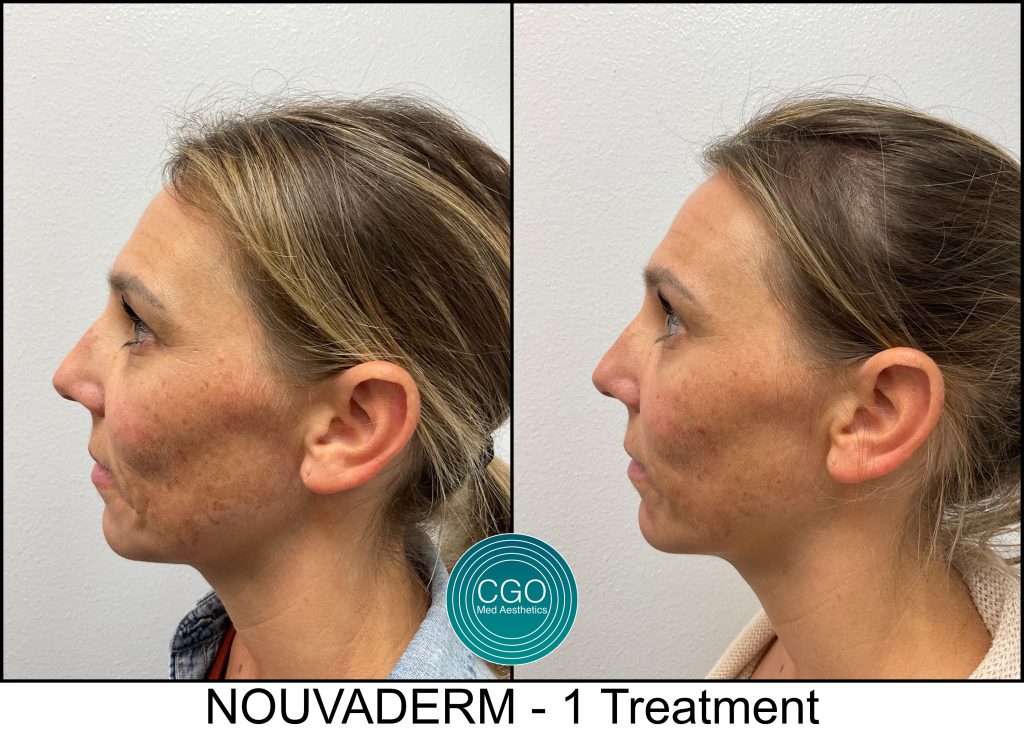 69a1bd4a5e39a3f0016f1ed2 48484514515 Scaled - Aesthetic Clinic San Diego