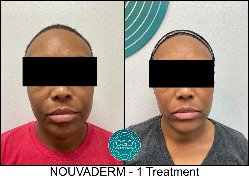69a1bd4a5e39a3f0016f1ed3 59749478948485 Scaled - Aesthetic Clinic San Diego