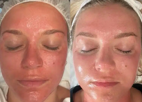 Physicians using EXO|E Skin Revitalizing Complex